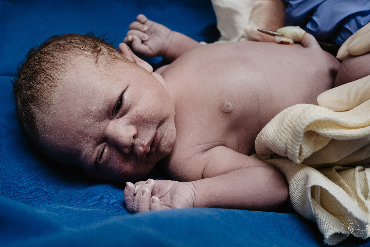 Bebê. Nascimento do Heitor. Parto Cesárea. Fotografia documental de parto por Thiago Braga.
