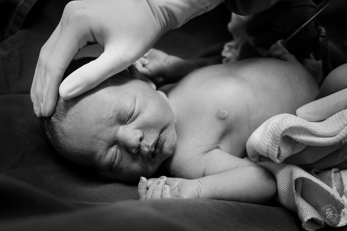 Bebê após o seu nascimento. Nascimento do Heitor. Parto Cesárea. Fotografia documental de parto por Thiago Braga.