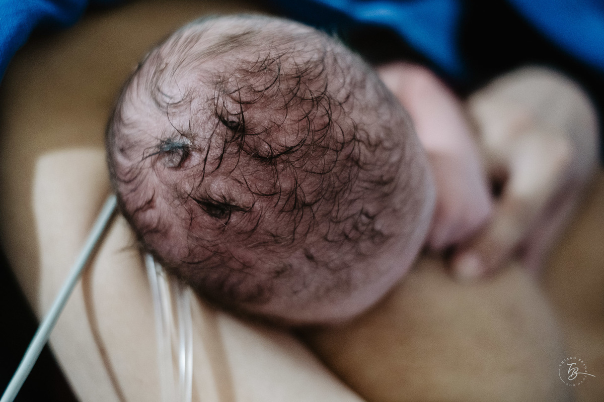 Cabelinho de recém nascido. Nascimento do Heitor. Parto Cesárea. Fotografia documental de parto por Thiago Braga.
