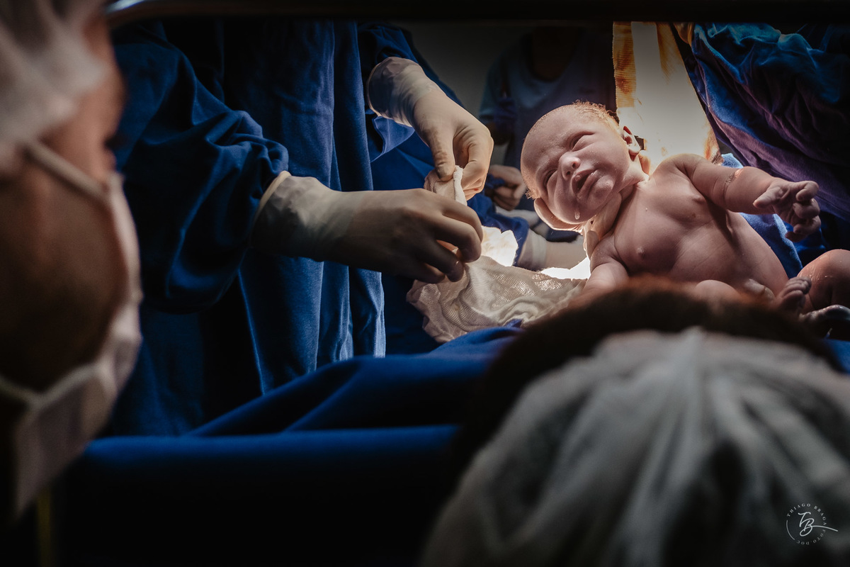 Olhar dos pais no nascimento do Heitor. Nascimento do Heitor. Parto Cesárea. Fotografia documental de parto por Thiago Braga.