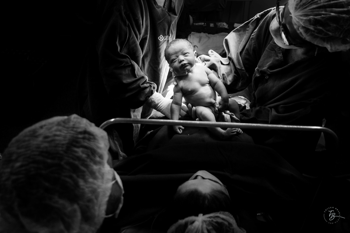 Cesárea na maternidade Santa Helena. Nascimento do Heitor. Parto Cesárea. Fotografia documental de parto por Thiago Braga.