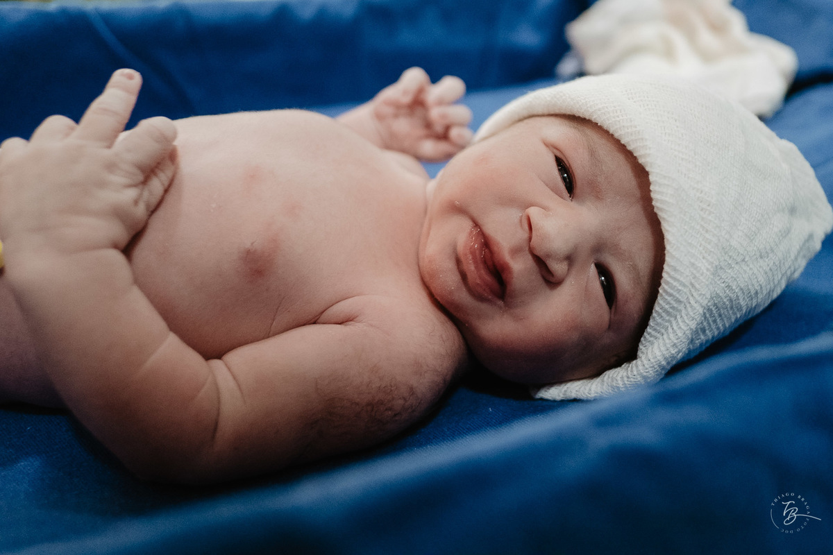 Olha eu. Parto cesárea na maternidade Ilha, em Florianópolis, por Thiago Braga Fotografia.