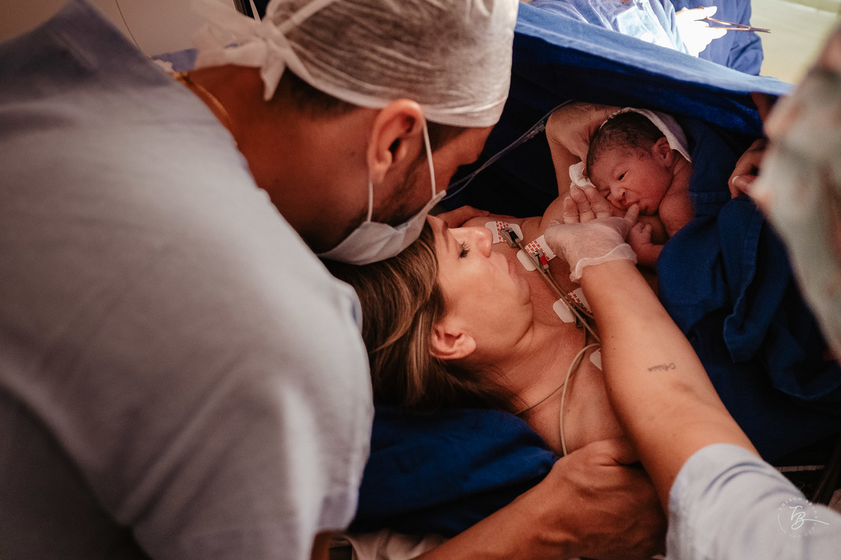 Amamentação logo depois do nascimento. Parto cesárea na maternidade Ilha, em Florianópolis, por Thiago Braga Fotografia.