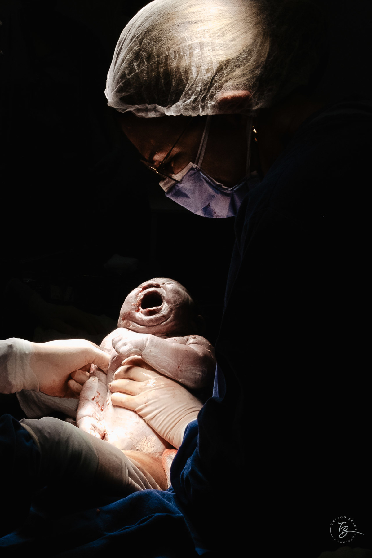 Fotografia de nascimento da Ísis, na Maternidade Santa Helena, com parto Cesárea, em Florianópolis - Sc, por Thiago Braga.