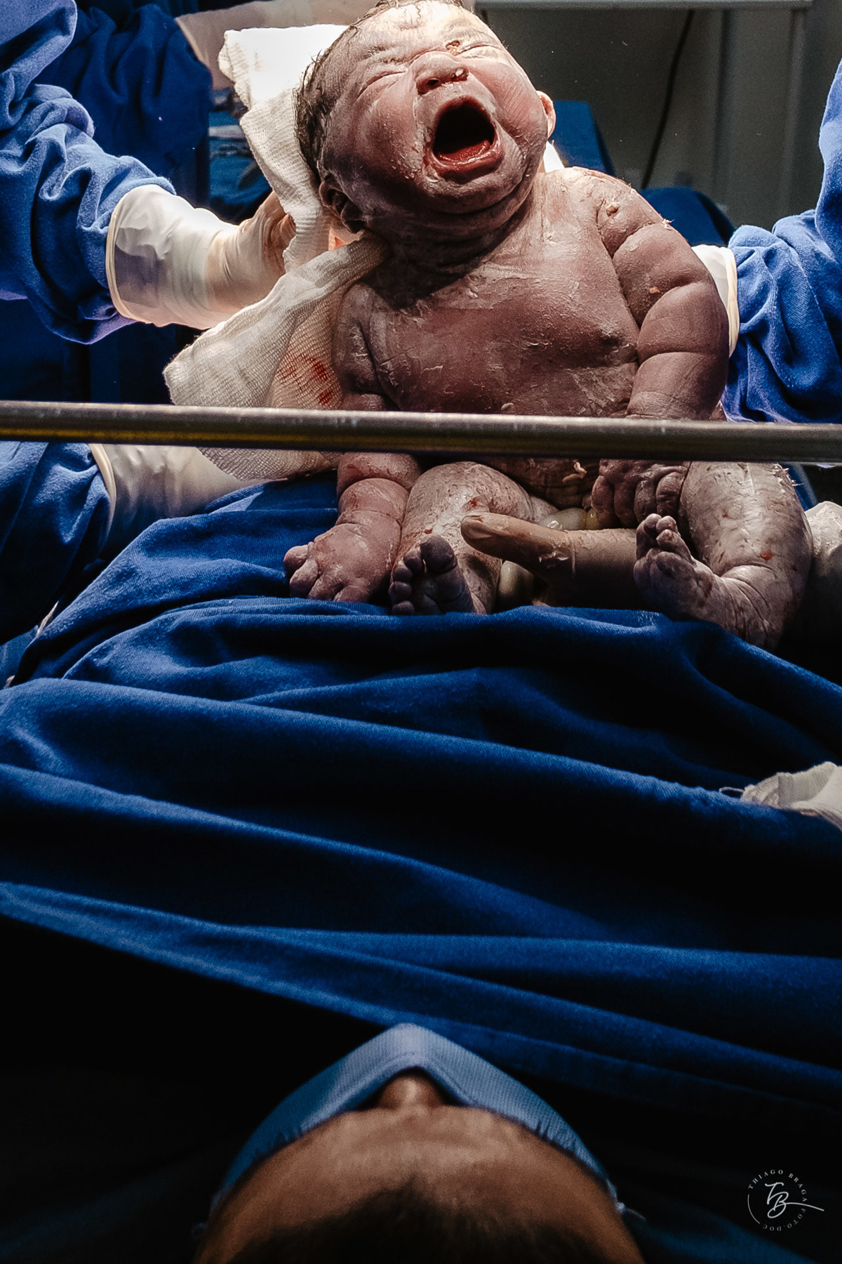 Fotografia de nascimento da Ísis, na Maternidade Santa Helena, com parto Cesárea, em Florianópolis - Sc, por Thiago Braga.