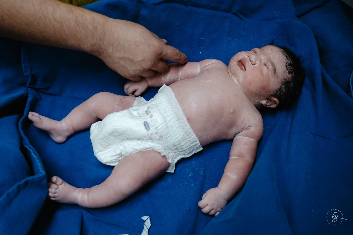 Fotografia de nascimento da Ísis, na Maternidade Santa Helena, com parto Cesárea, em Florianópolis - Sc, por Thiago Braga.