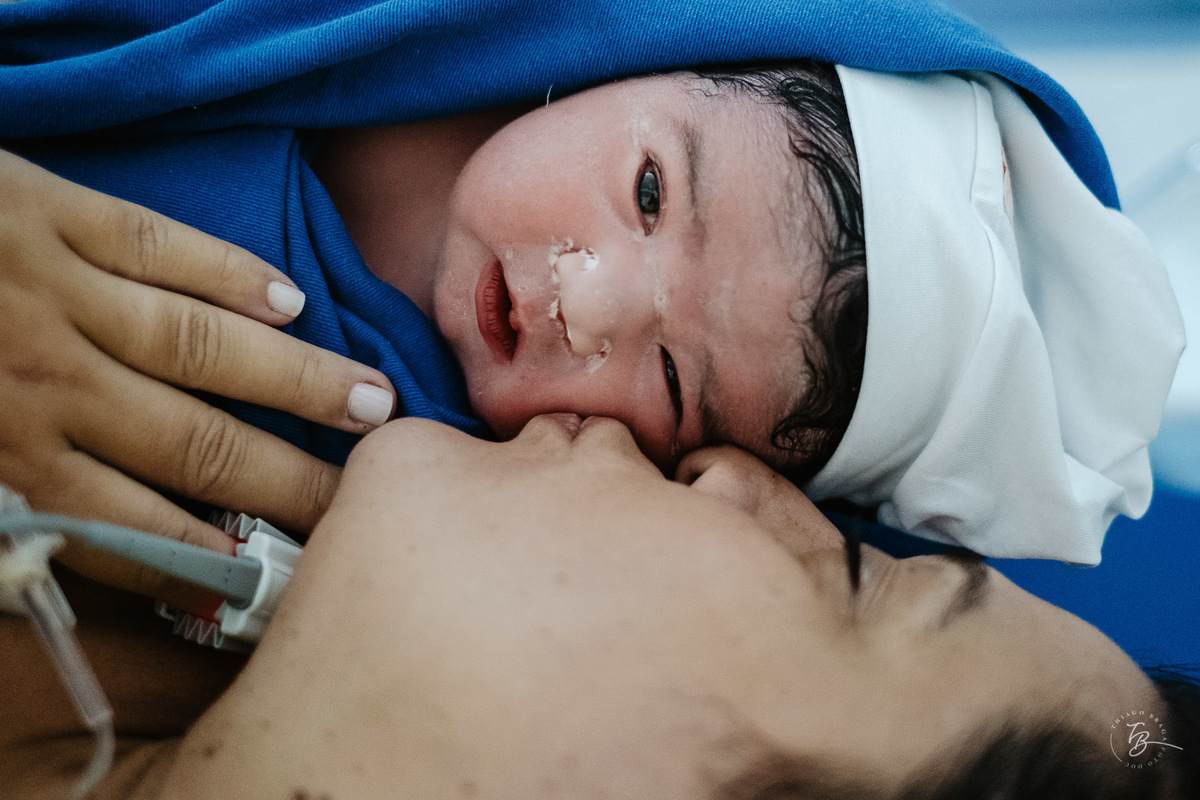 Fotografia de nascimento da Ísis, na Maternidade Santa Helena, com parto Cesárea, em Florianópolis - Sc, por Thiago Braga.