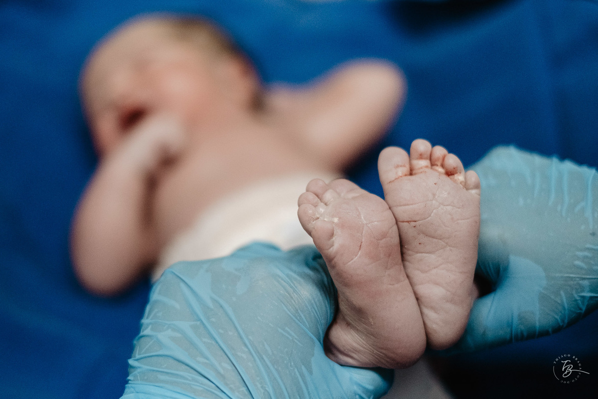 História do nascimento do Bernardo na Clínica Santa Helena em Florianópolis - SC por Thiago Braga Fotografia. 