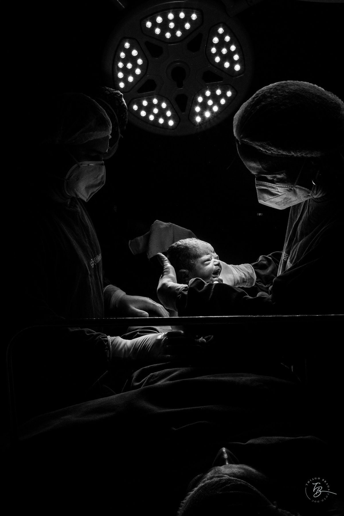 Fotografia documental de nascimento. Cesárea na Clínica e maternidade Santa Helena e Florianópolis, por Thiago Braga fotografia. 
