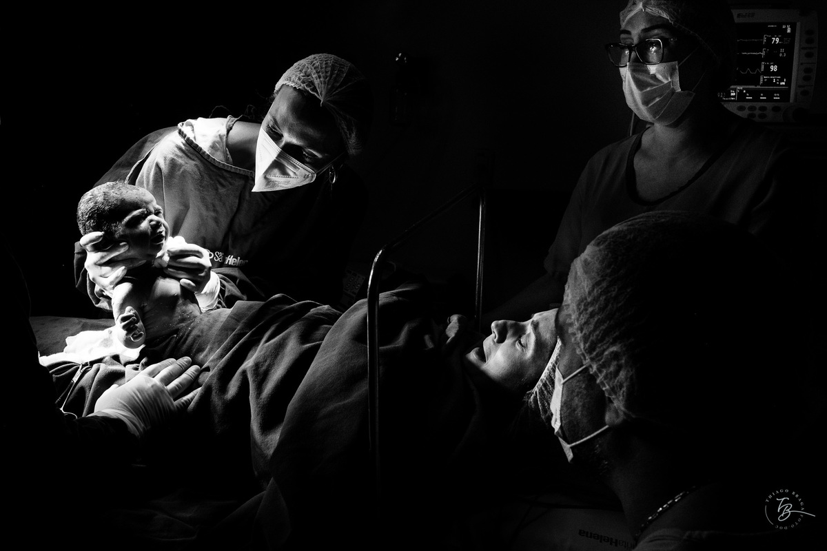 Fotografia documental de nascimento. Cesárea na Clínica e maternidade Santa Helena e Florianópolis, por Thiago Braga fotografia. 