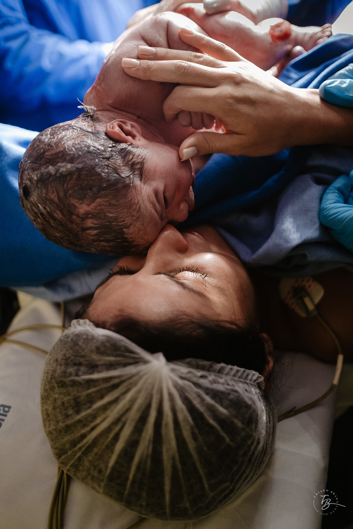 Fotografia documental de nascimento. Cesárea na Clínica e maternidade Santa Helena e Florianópolis, por Thiago Braga fotografia. 