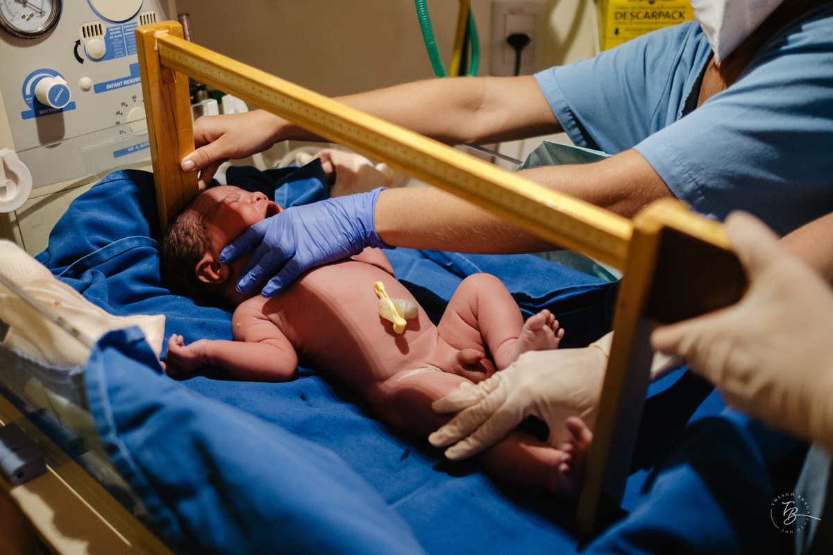 Fotografia documental de nascimento. Cesárea na Clínica e maternidade Santa Helena e Florianópolis, por Thiago Braga fotografia. 