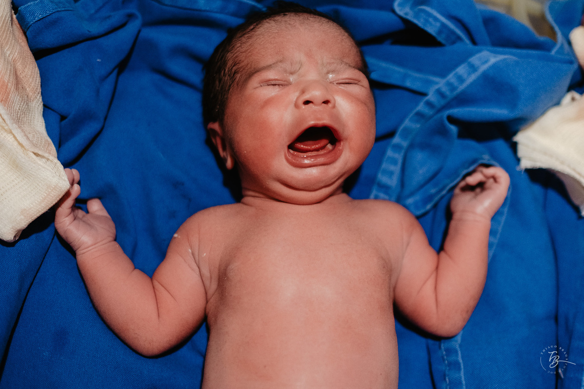 Fotografia documental de nascimento. Cesárea na Clínica e maternidade Santa Helena e Florianópolis, por Thiago Braga fotografia. 
