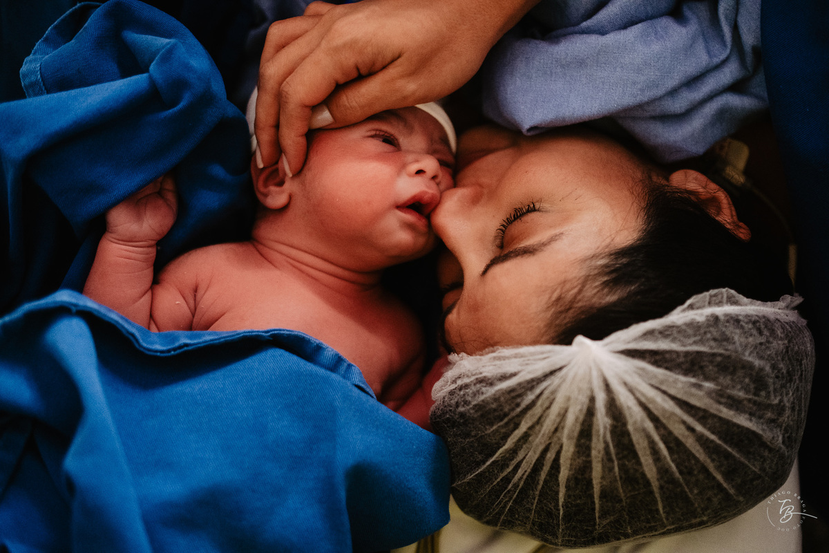Fotografia documental de nascimento. Cesárea na Clínica e maternidade Santa Helena e Florianópolis, por Thiago Braga fotografia. 