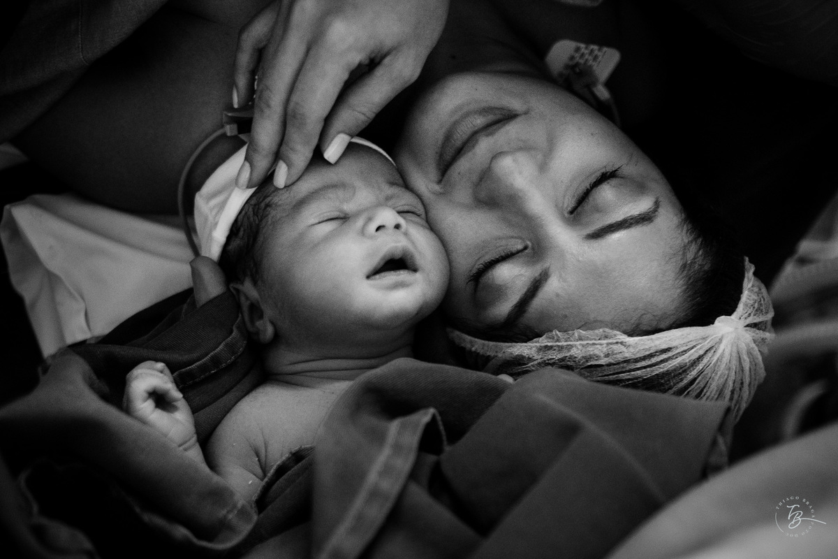 Fotografia documental de nascimento. Cesárea na Clínica e maternidade Santa Helena e Florianópolis, por Thiago Braga fotografia. 