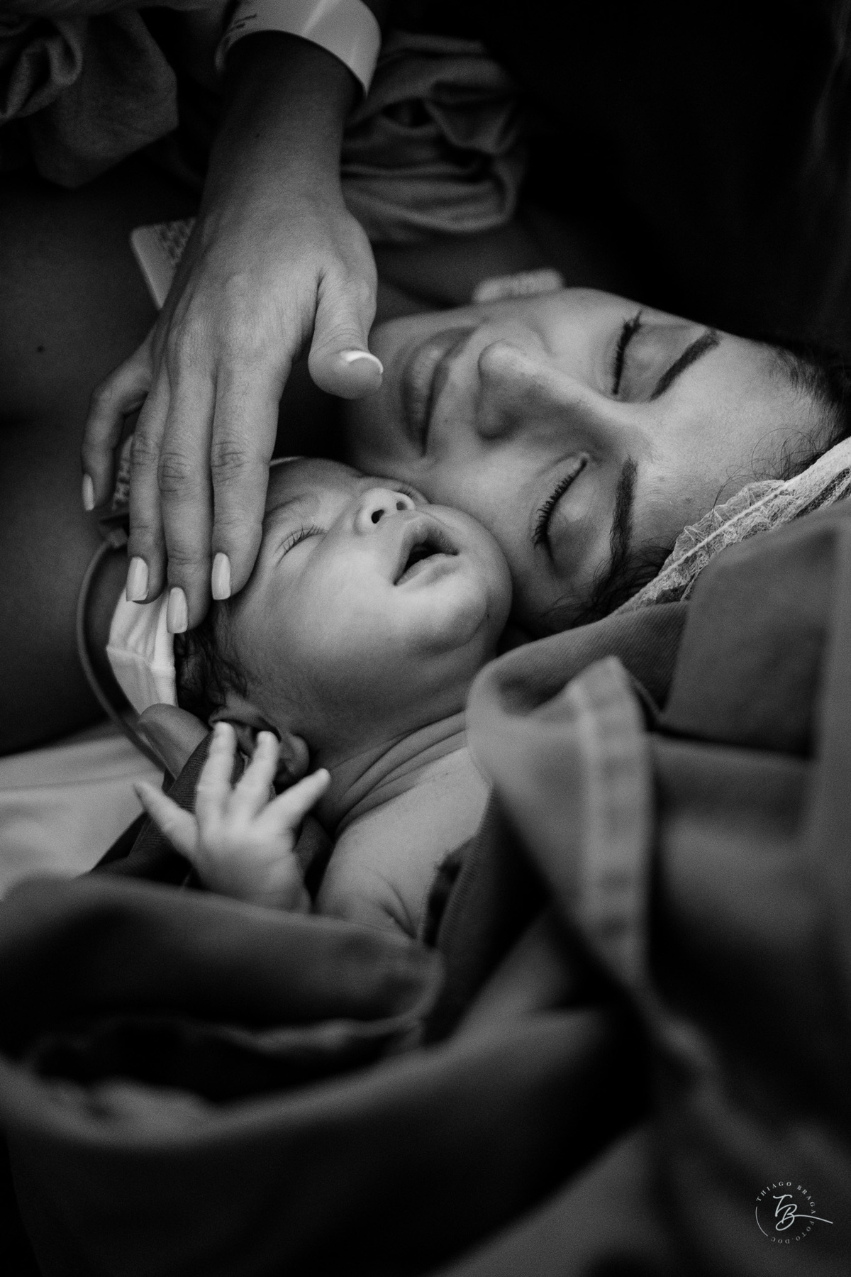 Fotografia documental de nascimento. Cesárea na Clínica e maternidade Santa Helena e Florianópolis, por Thiago Braga fotografia. 