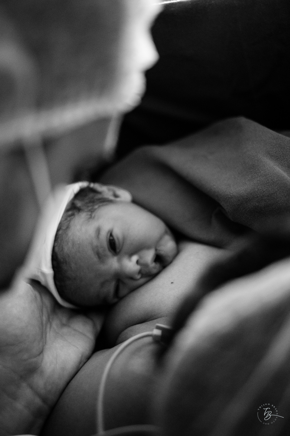 Fotografia documental de nascimento. Cesárea na Clínica e maternidade Santa Helena e Florianópolis, por Thiago Braga fotografia. 