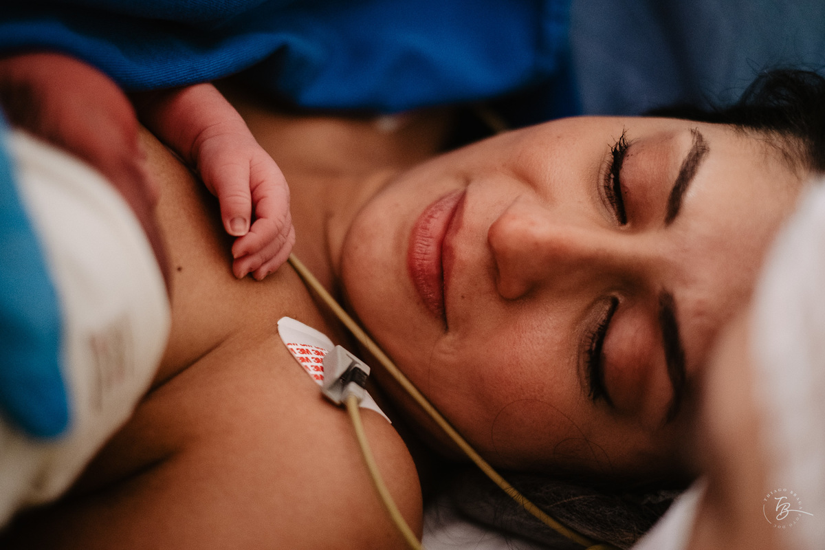 Fotografia documental de nascimento. Cesárea na Clínica e maternidade Santa Helena e Florianópolis, por Thiago Braga fotografia. 