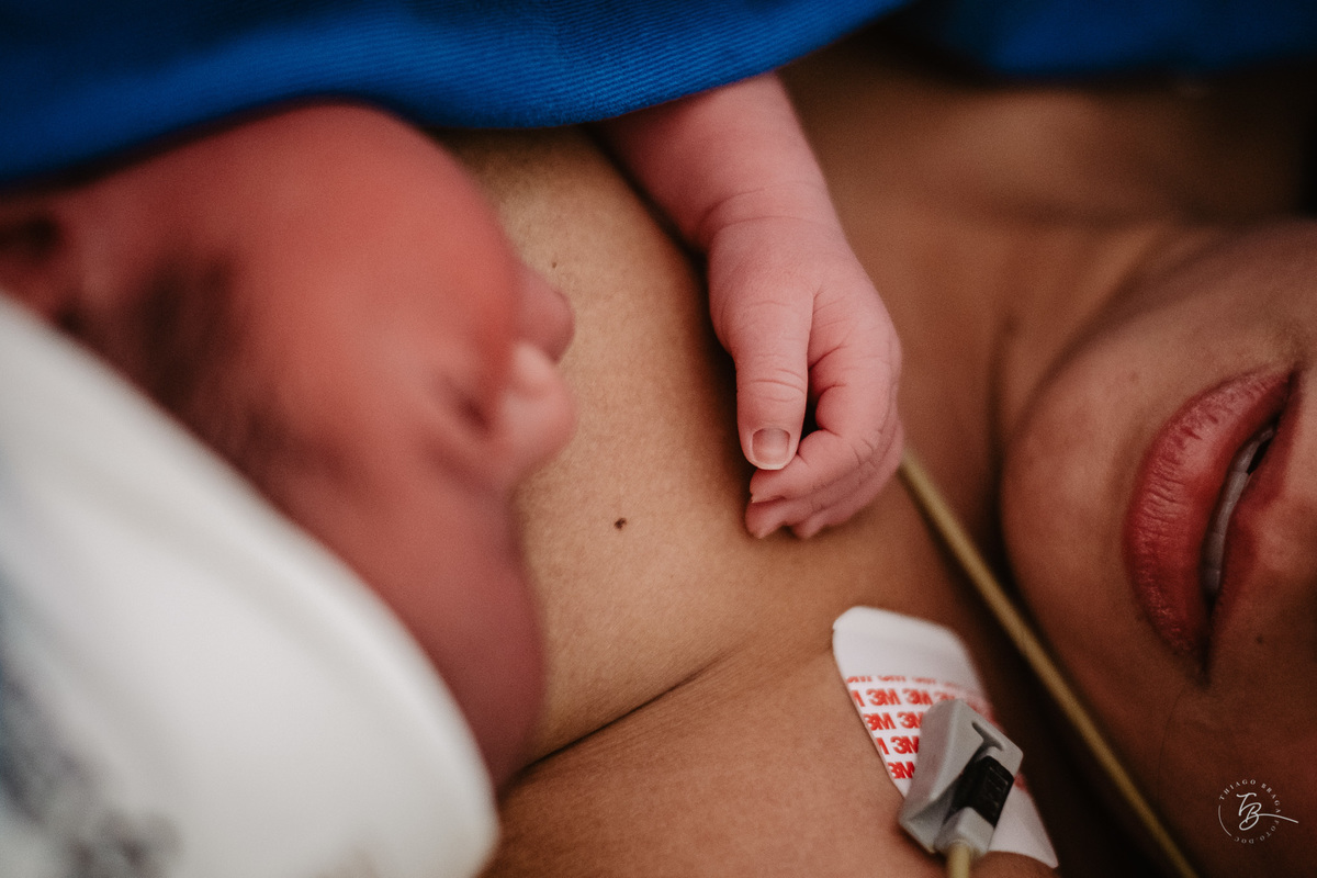 Fotografia documental de nascimento. Cesárea na Clínica e maternidade Santa Helena e Florianópolis, por Thiago Braga fotografia. 