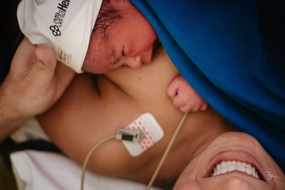 Fotografia documental de nascimento. Cesárea na Clínica e maternidade Santa Helena e Florianópolis, por Thiago Braga fotografia. 