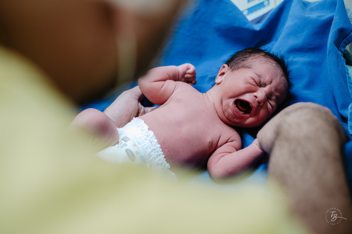 Fotografia documental de nascimento. Cesárea na Clínica e maternidade Santa Helena e Florianópolis, por Thiago Braga fotografia. 