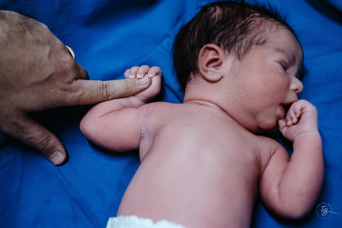Fotografia documental de nascimento. Cesárea na Clínica e maternidade Santa Helena e Florianópolis, por Thiago Braga fotografia. 