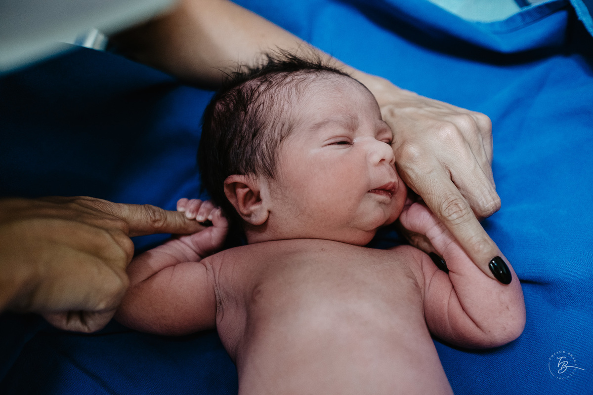 Fotografia documental de nascimento. Cesárea na Clínica e maternidade Santa Helena e Florianópolis, por Thiago Braga fotografia. 