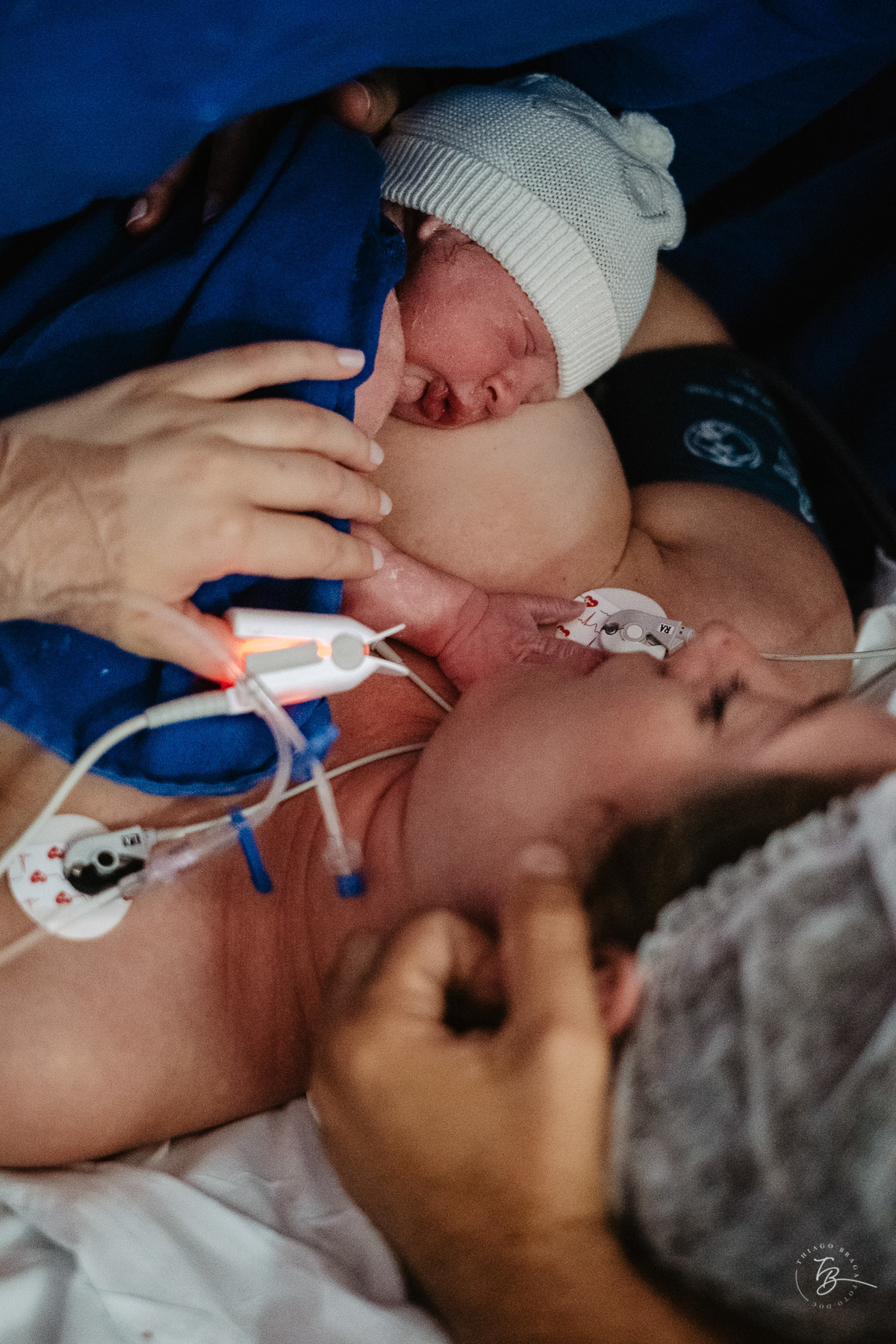 nascimento em uma cesárea humanizada no ilha hospital e maternidade, em Florianópolis/Sc. Registrado por Thiago Braga Fotografia. 