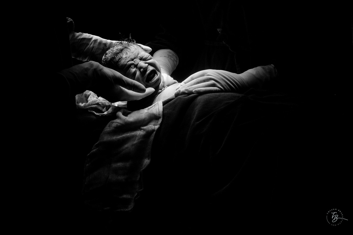 nascimento do Pedro, cesárea após indução na Clínica e Maternidade Santa Helena em Florianópolis, por Thiago Braga Fotografia. 