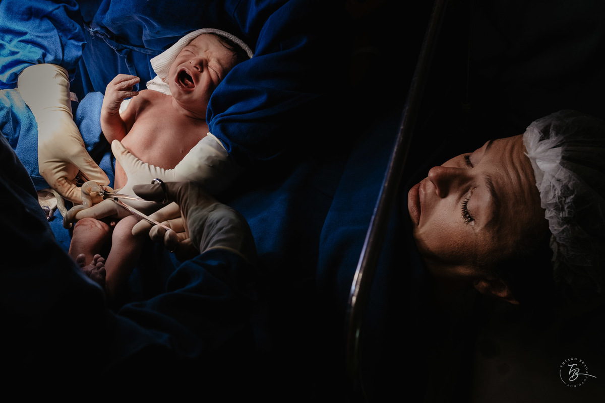 nascimento do Pedro, cesárea após indução na Clínica e Maternidade Santa Helena em Florianópolis, por Thiago Braga Fotografia. 