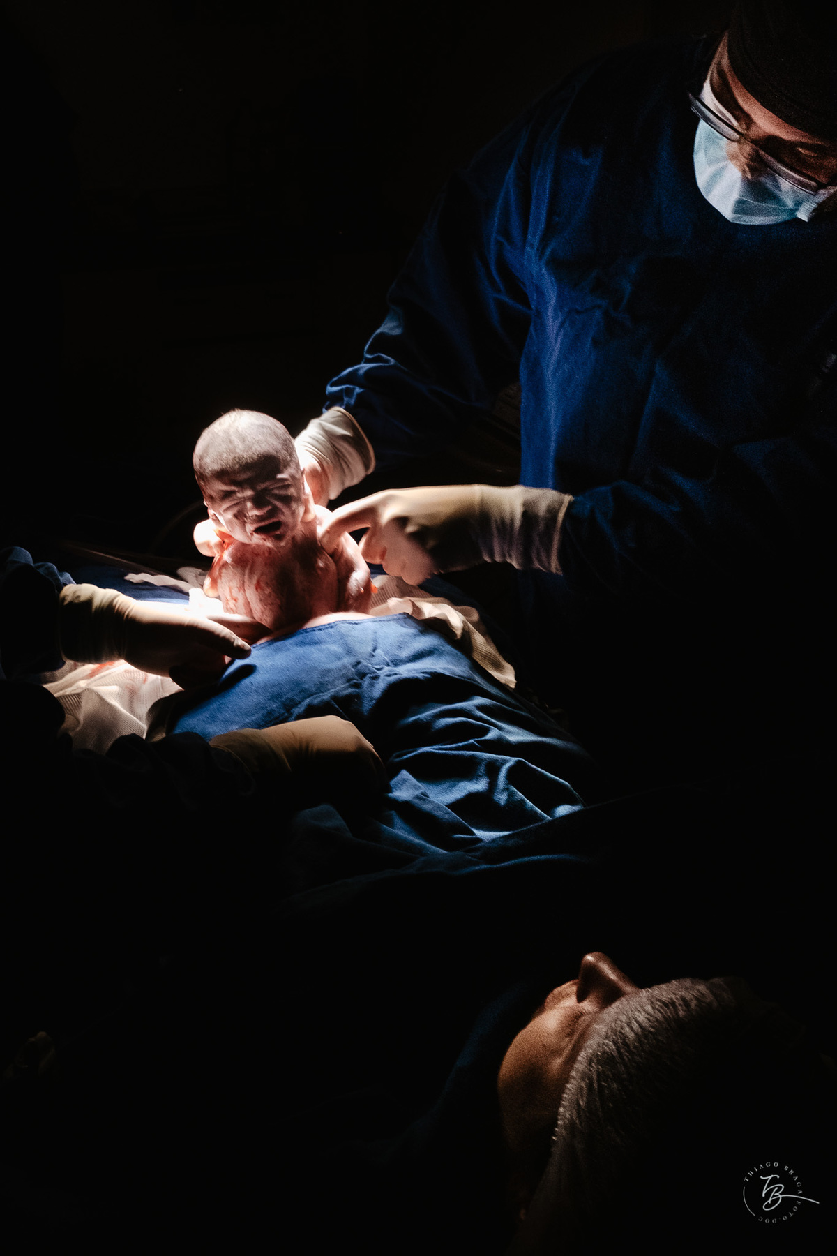 nascimento de cesárea no ilha hospital e maternidade, em Florianópolis, por Thiago Braga Fotografia