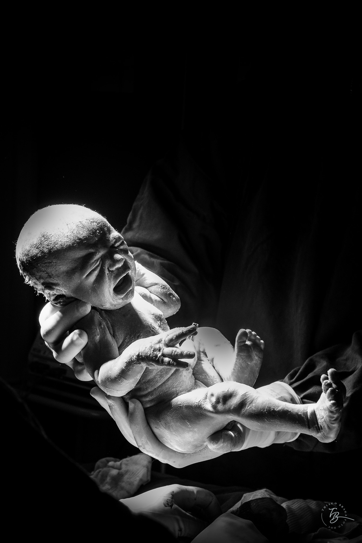 nascimento de cesárea no ilha hospital e maternidade, em Florianópolis, por Thiago Braga Fotografia