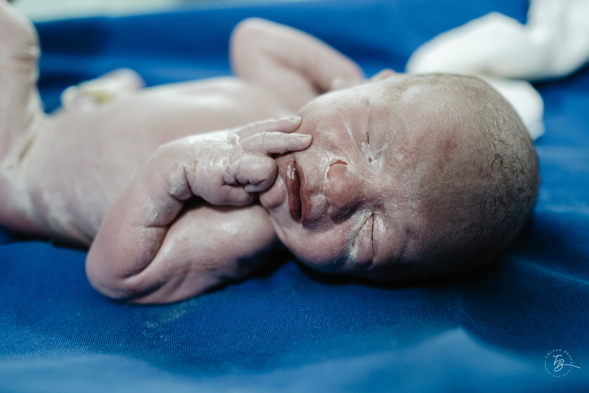 nascimento de cesárea no ilha hospital e maternidade, em Florianópolis, por Thiago Braga Fotografia