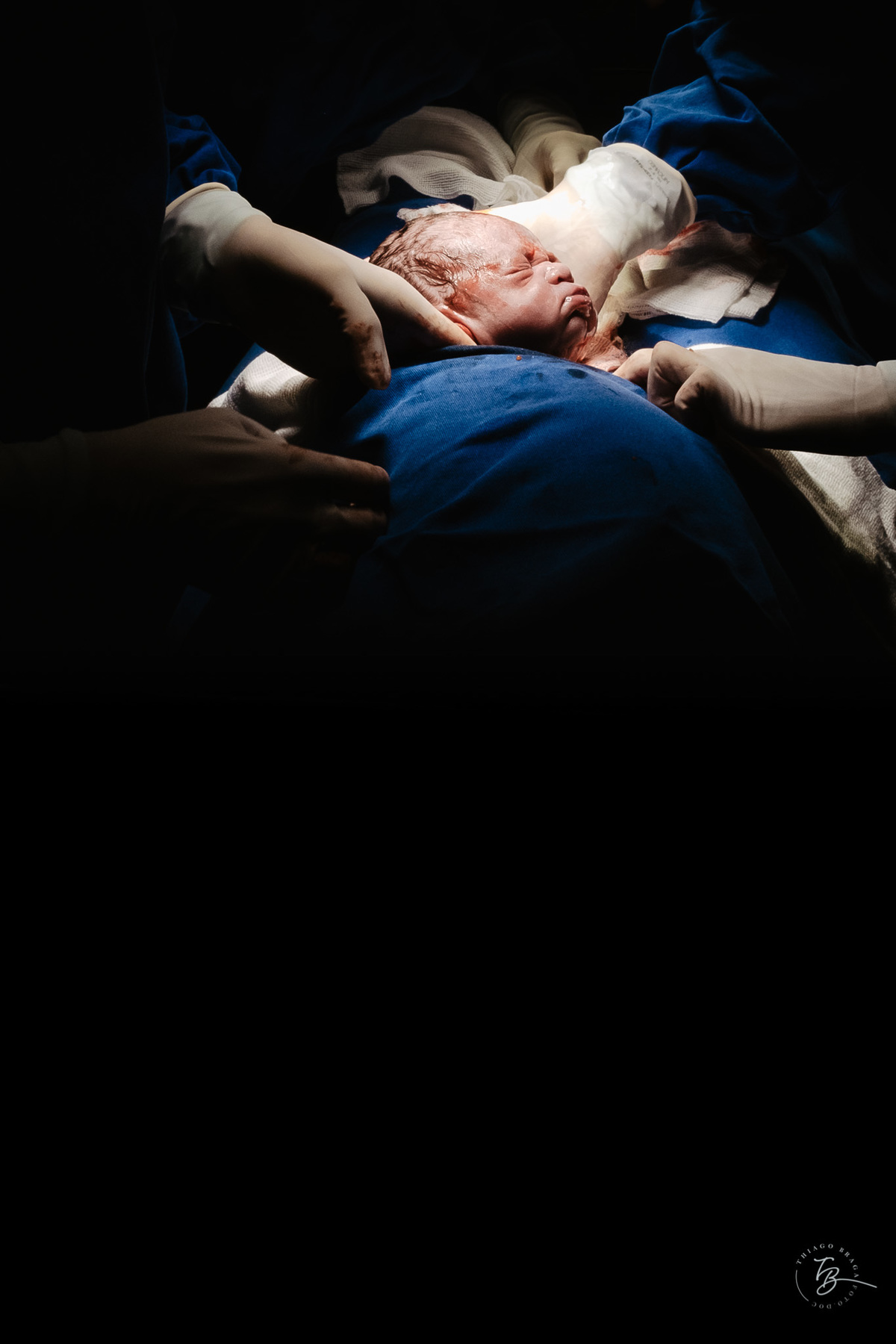 fotografia de nascimento na maternidade santa helena por Thiago Braga fotografia