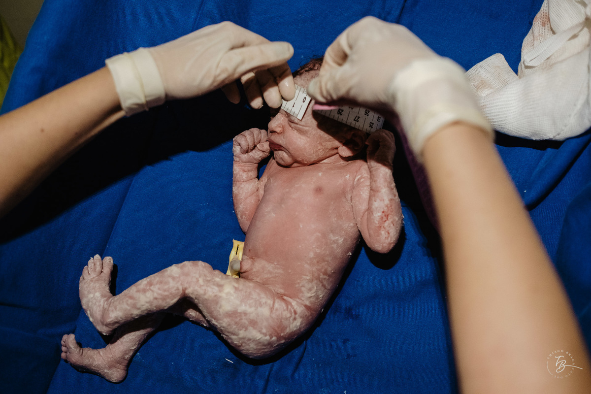 fotografia de nascimento na maternidade Santa Helena em Florianópolis por Thiago Braga