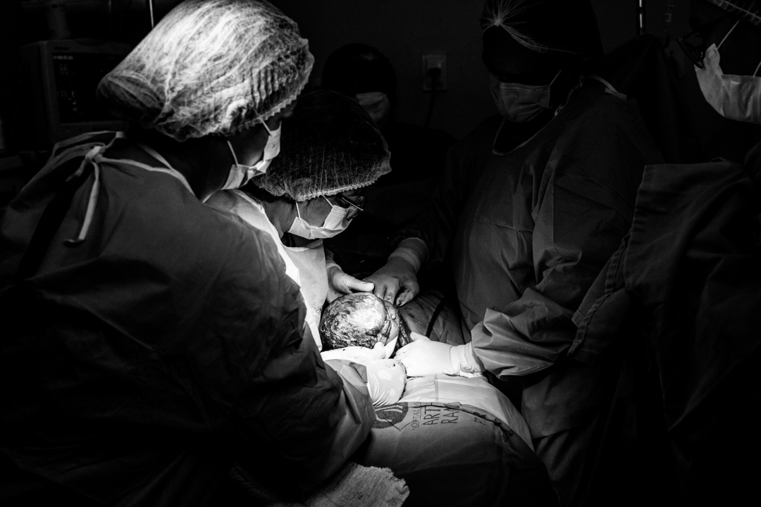 fotografia de parto em maceió no hospital arthur ramos gabi coelho