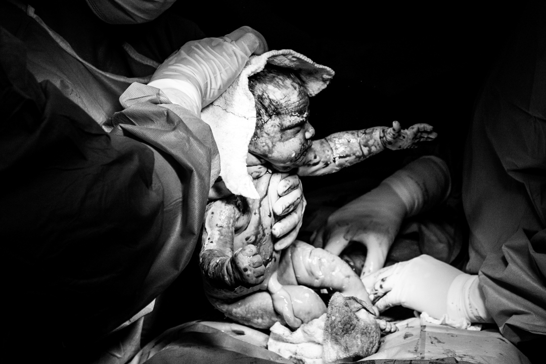 fotografia de parto em maceió no hospital arthur ramos gabi coelho