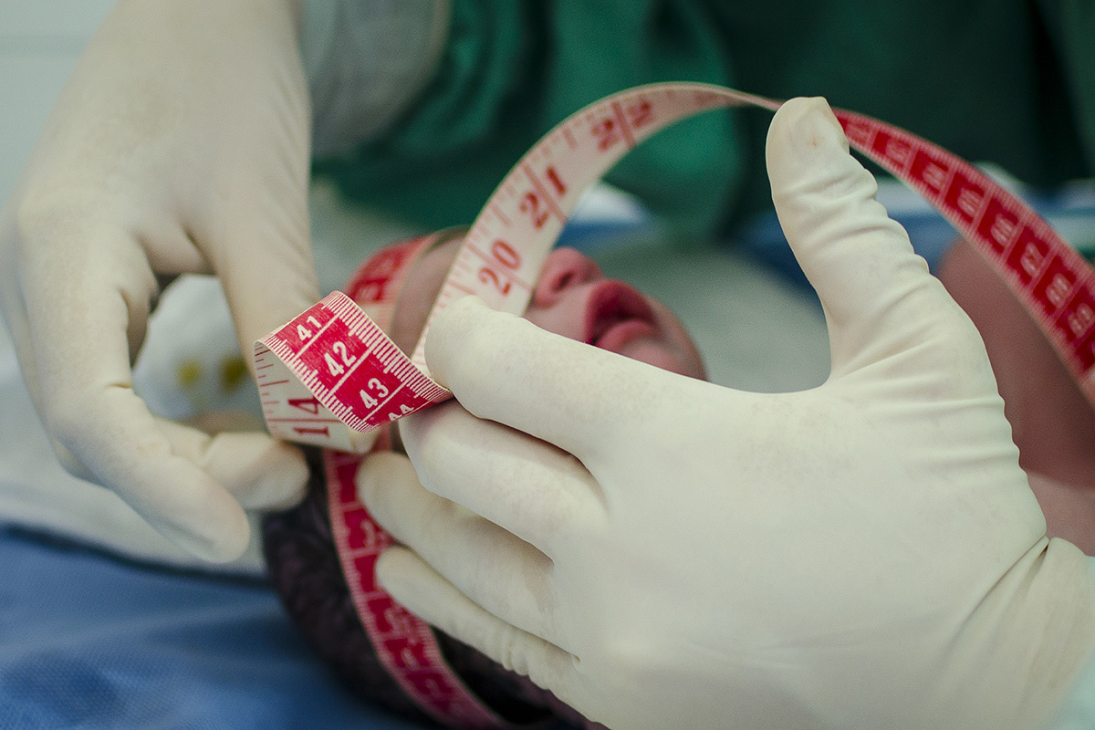 medição de perímetro cefálico