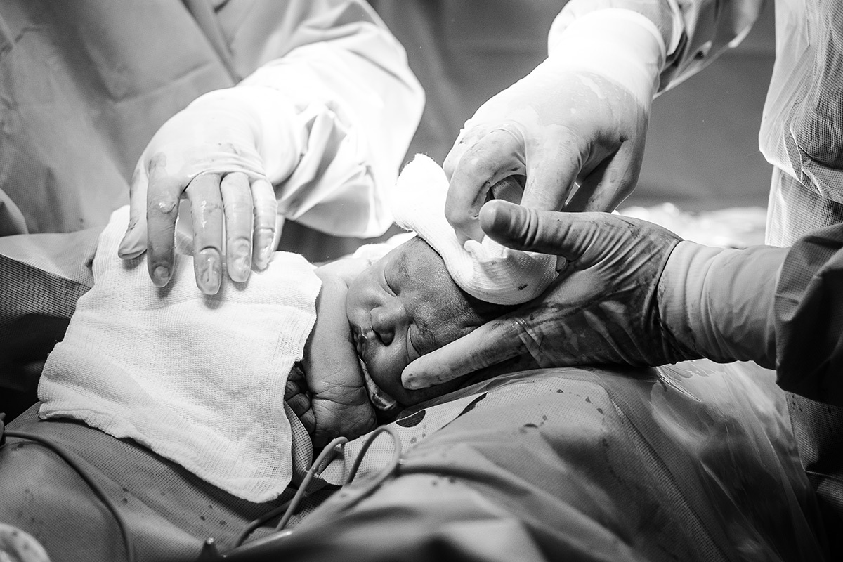 parto bebê saindo da barriga da mãe