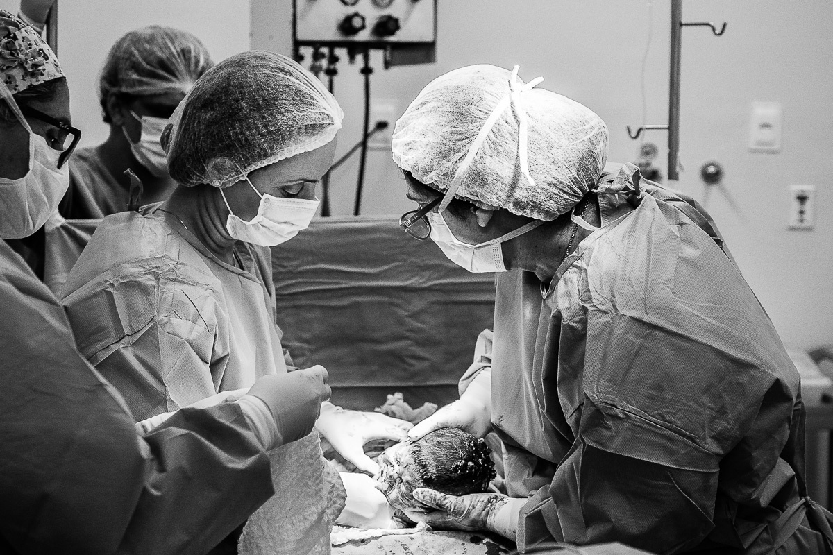 bebê saindo da barriga da mãe