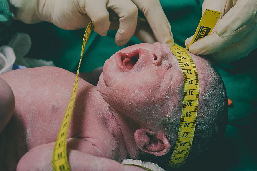 perímetro cefálico