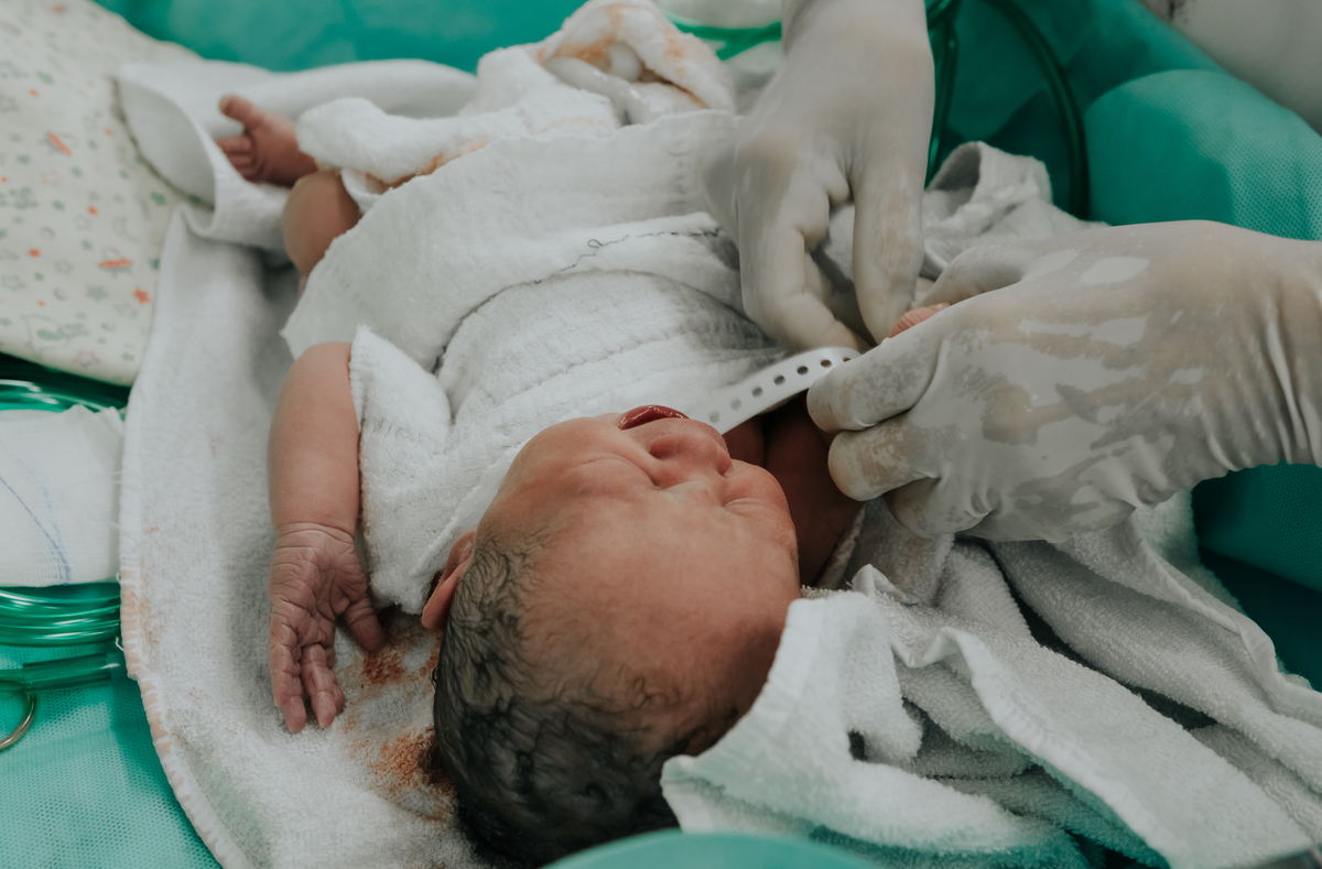 fotos de parto, perinatal, parto cesárea, cesárea, fotografia newborn, fotografia newborn barra da tijuca, fotografia newborn rj, fotografia de parto, foto de parto cesárea, fotógrafa de parto, fotógrafa de bebês, rita kessler, melhor fotógrafa newborn