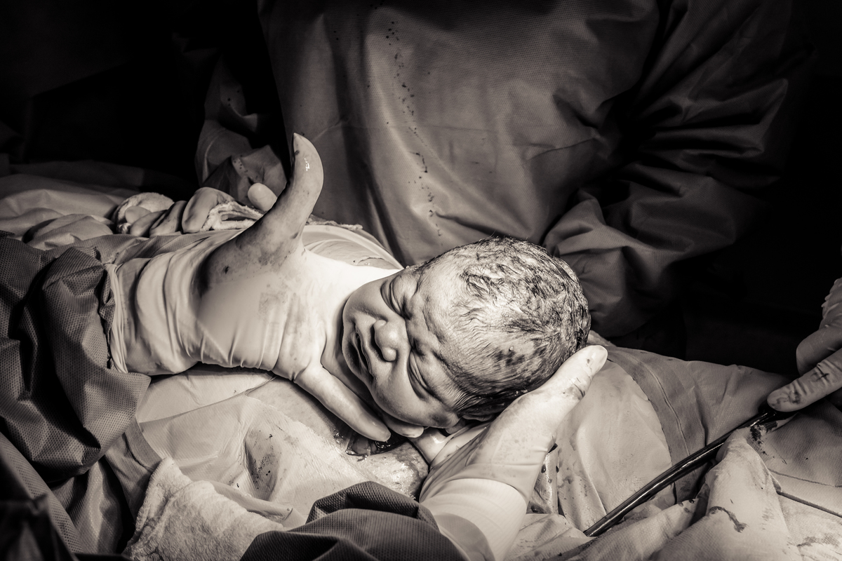 registro de parto, fotos de parto, fotos parto cesárea, perinatal, perinatal barra, fotografia de parto, cobertura fotográfica de parto, foto de bebê, newborn, newborn barra, newborn rio de janeiro, parto cesárea, gestante, foto de gestante, newborn rj