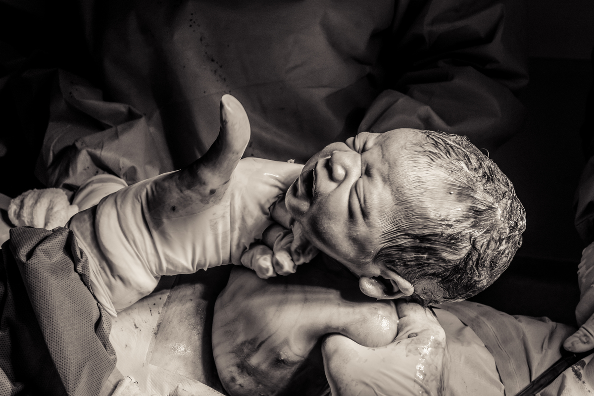 registro de parto, fotos de parto, fotos parto cesárea, perinatal, perinatal barra, fotografia de parto, cobertura fotográfica de parto, foto de bebê, newborn, newborn barra, newborn rio de janeiro, parto cesárea, gestante, foto de gestante, newborn rj