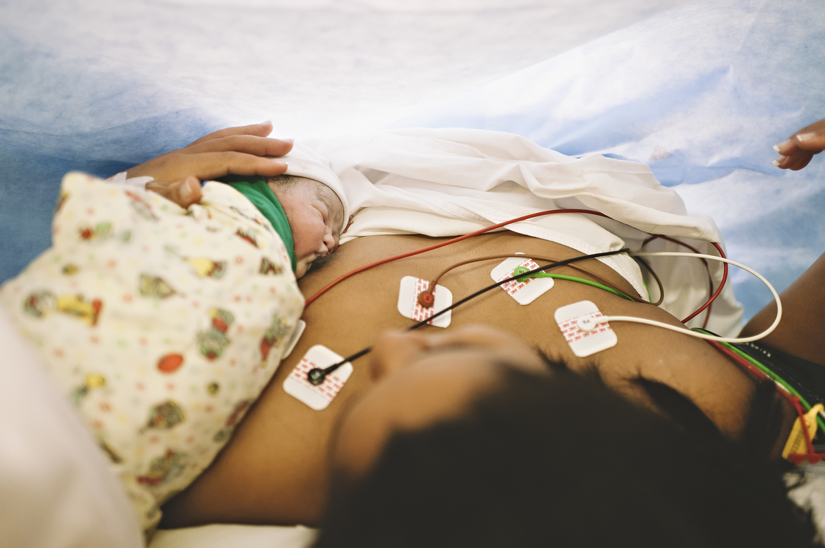 parto, fotografia de parto, sala de parto, perinatal barra, perinatal, casa de saúde são josé, nascimento, fotos na maternidade, parto cesárea, parto normal, cesariana, 