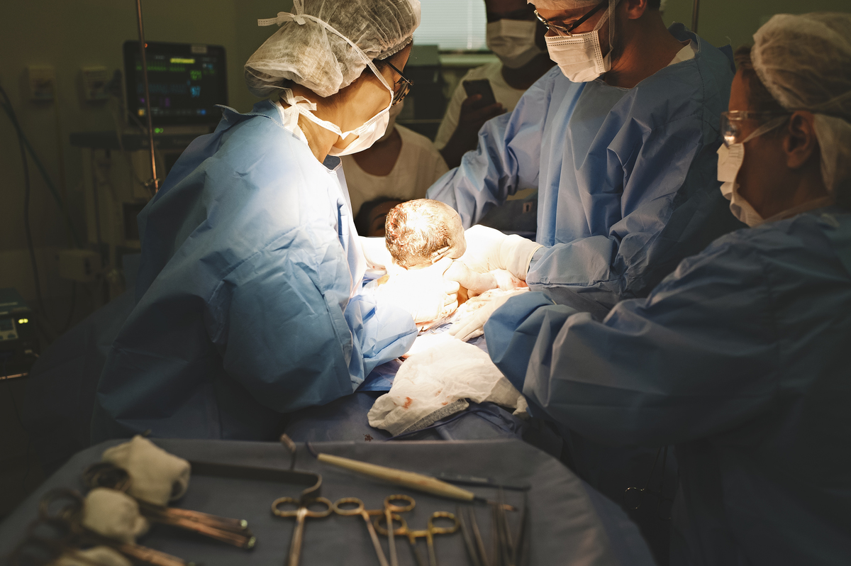 parto, fotografia de parto, sala de parto, perinatal barra, perinatal, casa de saúde são josé, nascimento, fotos na maternidade, parto cesárea, parto normal, cesariana, 