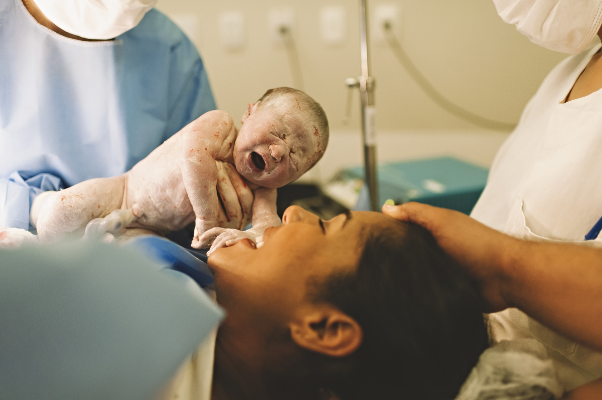 parto, fotografia de parto, sala de parto, perinatal barra, perinatal, casa de saúde são josé, nascimento, fotos na maternidade, parto cesárea, parto normal, cesariana, 