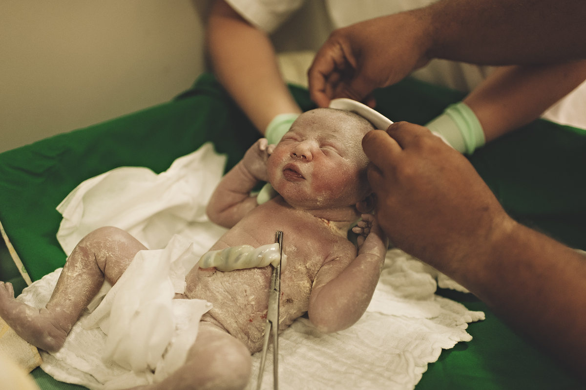 parto, fotografia de parto, sala de parto, perinatal barra, perinatal, casa de saúde são josé, nascimento, fotos na maternidade, parto cesárea, parto normal, cesariana, 