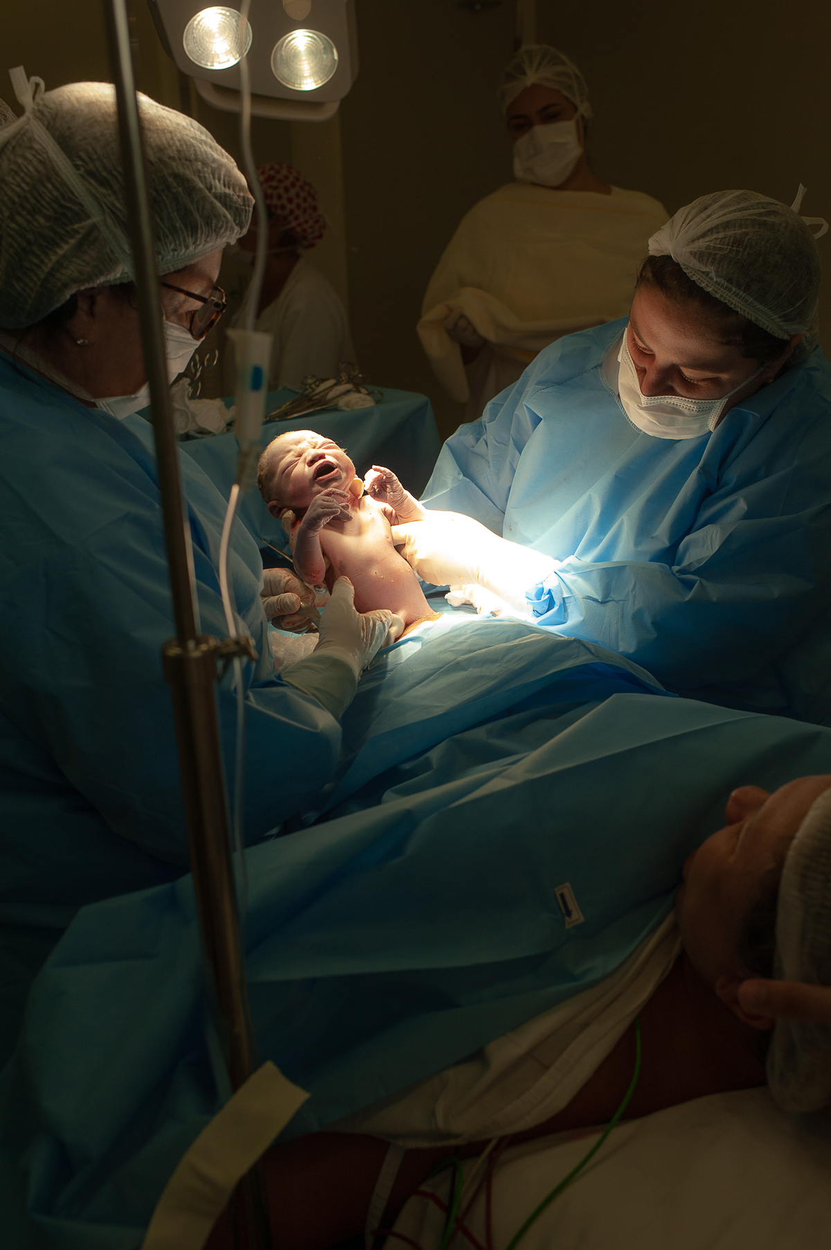 fotografia de parto, fotos de parto, perinatal barra, cesárea, parto humanizado, parto normal, parto natural, cesariana, melhor fotógrafa newborn no rio, best newborn photographer in rio, fotografia newborn barra da tijuca, newborn barra da tijuca


