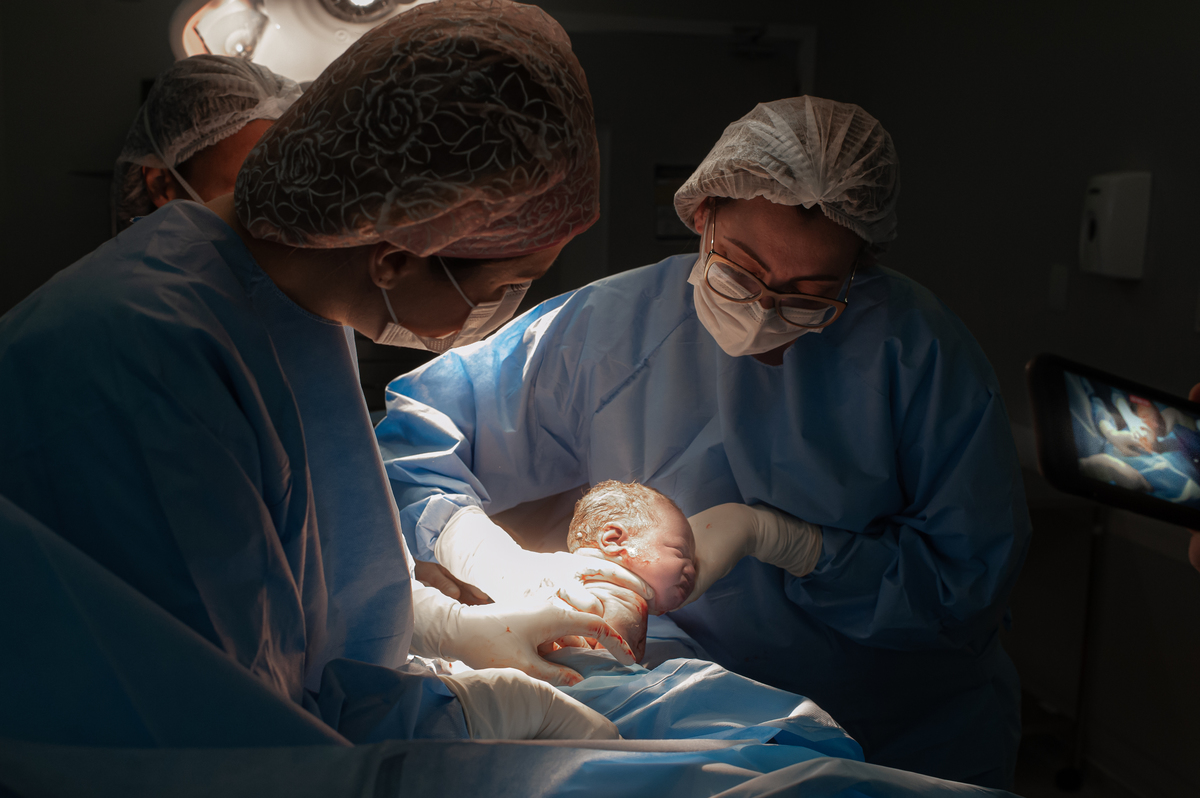 fotografia de parto, foto de parto, registro fotografico de parto, parto cesarea, fotos de cesarea, fotografa de parto, foto de nascimento, foto de parto na perinatal, melhor fotografa de partos